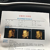 大家看看是男孩女孩