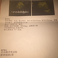 求大神告知一下是男宝宝还是女宝宝，在线等🙆