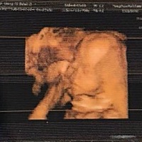 我睡觉十分的野蛮 怀孕七个多月了 对不会对宝宝有影响？控制不住阿