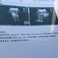 这是不是不太好啊，现在停经47天，今天检查孕酮偏低，而且昨天和今天有黄褐色分泌物，一周以后还要复查...