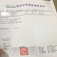 准备怀孕，然后检查结果是这个，我是必须要治疗好再怀孕吗？要是现在怀了后期会有什么影响？什么后果吗...