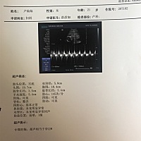 今天刚照的，就是不知道男孩女孩，想问问有没有会看的