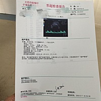 快要和你见面了，有点激动