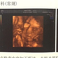 三维检查的时候，一直挡着半年脸不让看。。。