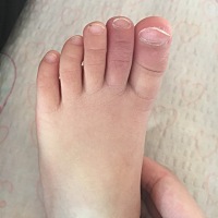 谁知道这是怎么回事，刚开始是左二红肿现在是右二和小指红肿 不痒 有点痛