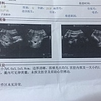 末次月经开始日12.20 来了十多天，2号才结束，前两天检查怀孕了，谁知道现在宝宝是几周 这个怎么算啊？