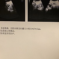 有人会看男女吗，今天第一次做b超