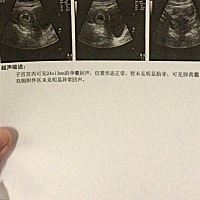 这是可以留下来的意思吗，医生都不回复我