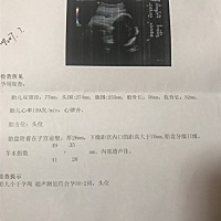 医生说孩子有点小，，正常吗？可以看出来男孩女孩吗？