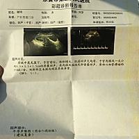 宝宝正常，怀孕八周➕1 有看出男宝宝女宝宝的吗？