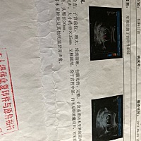 各位宝妈帮忙看看是男宝还是女宝，这是一开始怀孕到现在做的所有b超，现在33周了