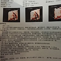 是男是女，看得出来吗？刚做的四维。