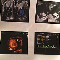 有宝妈会看男女吗？帮忙看看，很期待