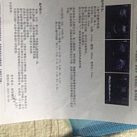 上面的胎盘点状钙化有问题的吗？