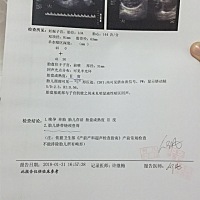 美女们，我怀的是男宝宝还是女宝宝？？求告知。