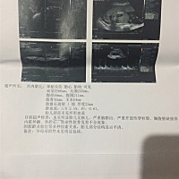 这样可以检查到鼻子嘴巴吗