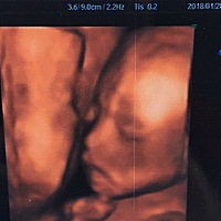 22周 高鼻梁宝贝