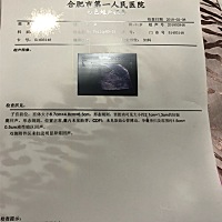 怀孕60天没查到胎芽胎心，医生建议打掉，哭了很久难过死了，还会有奇迹吗？怎么办怎么办好舍不得