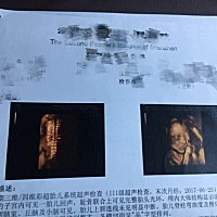 有时越看越感觉鼻子真大。。。