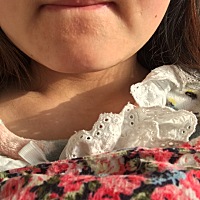 有没有跟我一样满脸长满小痘痘的？医生说是胎毒，不能吃药，抹药膏……只能忍着，我现在真的没脸见人了...