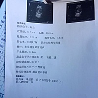 谁会计算孩子多少斤了