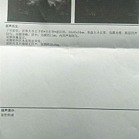 40天了看不到孕囊好害怕..