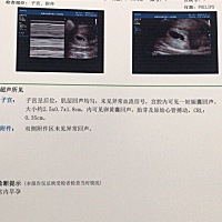 宝妈们，我怀孕快两个月了，我坐飞机过了一次安检，因为当时不知道怀孕了，她们说安检辐射特别大，会有...