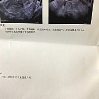 今天去医院，复检，自然流产干净了，下次怀要等半年，2.11-8.11左右。那么7月份开始就备孕了吧。