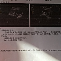 月经末期是12.25号，前几天去医院做了B超，医生说胎心胎芽都有，就是孕囊位置在中下段，心理还是比较担...