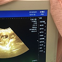 帮我看看这个照片，都能看出来什么呀，知道的告诉一下，谢谢