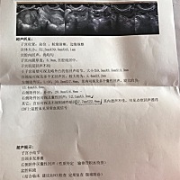 宫外孕流产后检查出来各种妇科炎症。在这之前也没发现自己身体有什么异样啊。平时月经正常，周期一般在3...