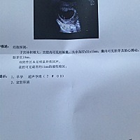 大家有知道的可以帮忙看看男宝宝还是女宝宝呀，怀孕七周做的B超，着急