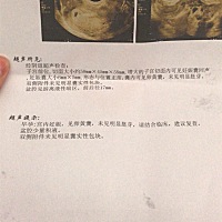 各位宝妈能看懂吗？医生说得好吓人，说一周后复诊，因为还没确定是不是活的💔