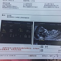 能看男女吗，二宝了，我老公和我都觉得男女无所谓，可是他家人非要我们生男孩，想先知道，有个心理准备。