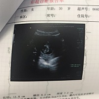 各位有经验的孕妈宝妈们，帮忙看看男宝女宝嘞！二胎