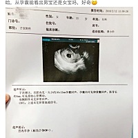 12.26末次，2.5做阴超还没见胎心胎芽，今天检查出来了，看见屏幕上的他像个小心脏一样“砰砰砰”的跳�...