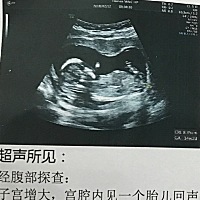 男宝女宝可以帮我看一下么？有懂的宝妈么？