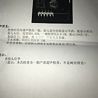 你们有孩子后有没有用过电脑和手机，医生说玩手机相当于做一次B超，我从有孩子到现在一直穿那防辐射衣服...