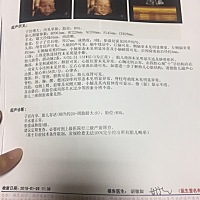 这是24周照的三维，不知是👦🏻还是👧🏻😘ོ有看得懂B超的吗？