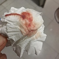 怀孕一个月零三天，上厕所发现流血是不是流产得预兆……