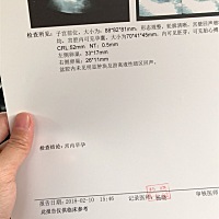 可以看出男宝女宝吗