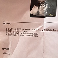 大家看一次。预计几个月了