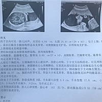 看不懂，谁能给解释解释。小孩这是看不清吗，怎么没看到形状