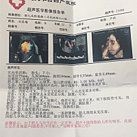 今天刚做的四维复查。各位亲帮忙分析分析男女呗