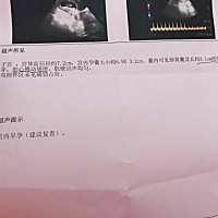 怀孕73天，子宫前后径值反而比上次检查的值小了。这个b超形状是不是正常的。请大家有经验的朋友帮我看看...