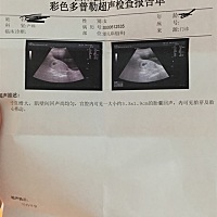 42天的时候还没看到胎心 今天查到有了 接好运