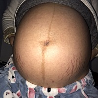 孕35 4，麻烦各位有经验的妈妈，帮我看看是男宝还是女宝。请忽略妊娠纹。