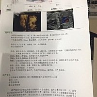 还有50多天预产期 还是不知道是男宝还是女宝