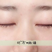 各位美女们好，我是明月，在这分享好物，扫扰了。有没有想增长自身短睫毛的，我自己有在坚持用，很明显...