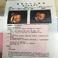 今天做四维彩超，医生不让我光和他说话，医生给我看宝宝，我激动的哭了，只有一个直太高，让2周后再复查...